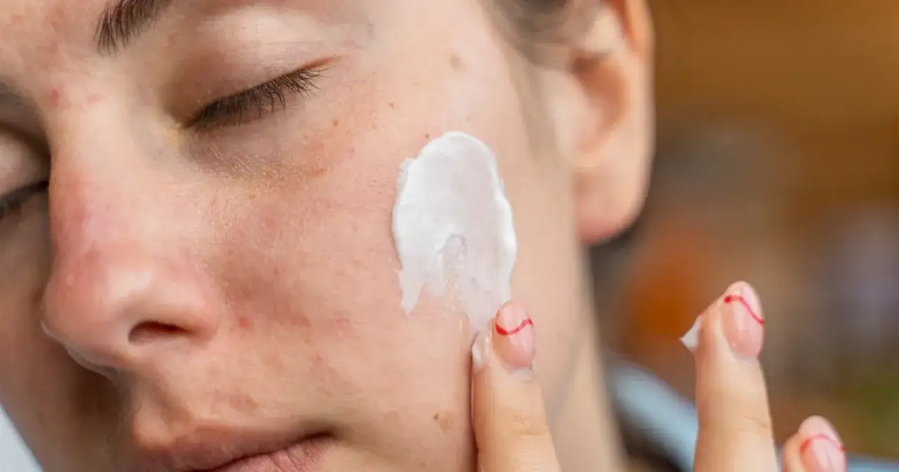 Kwas azelainowy a retinol: aplikacja kremu na twarz z piegami i niedoskonałościami.