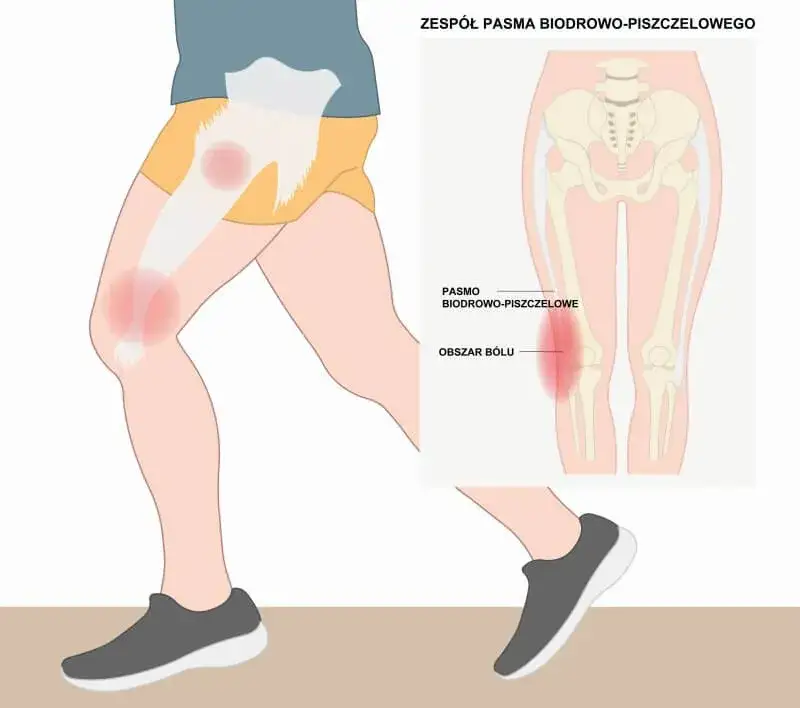 różnica między dobrym a złym bólem w rehabilitacji grafika