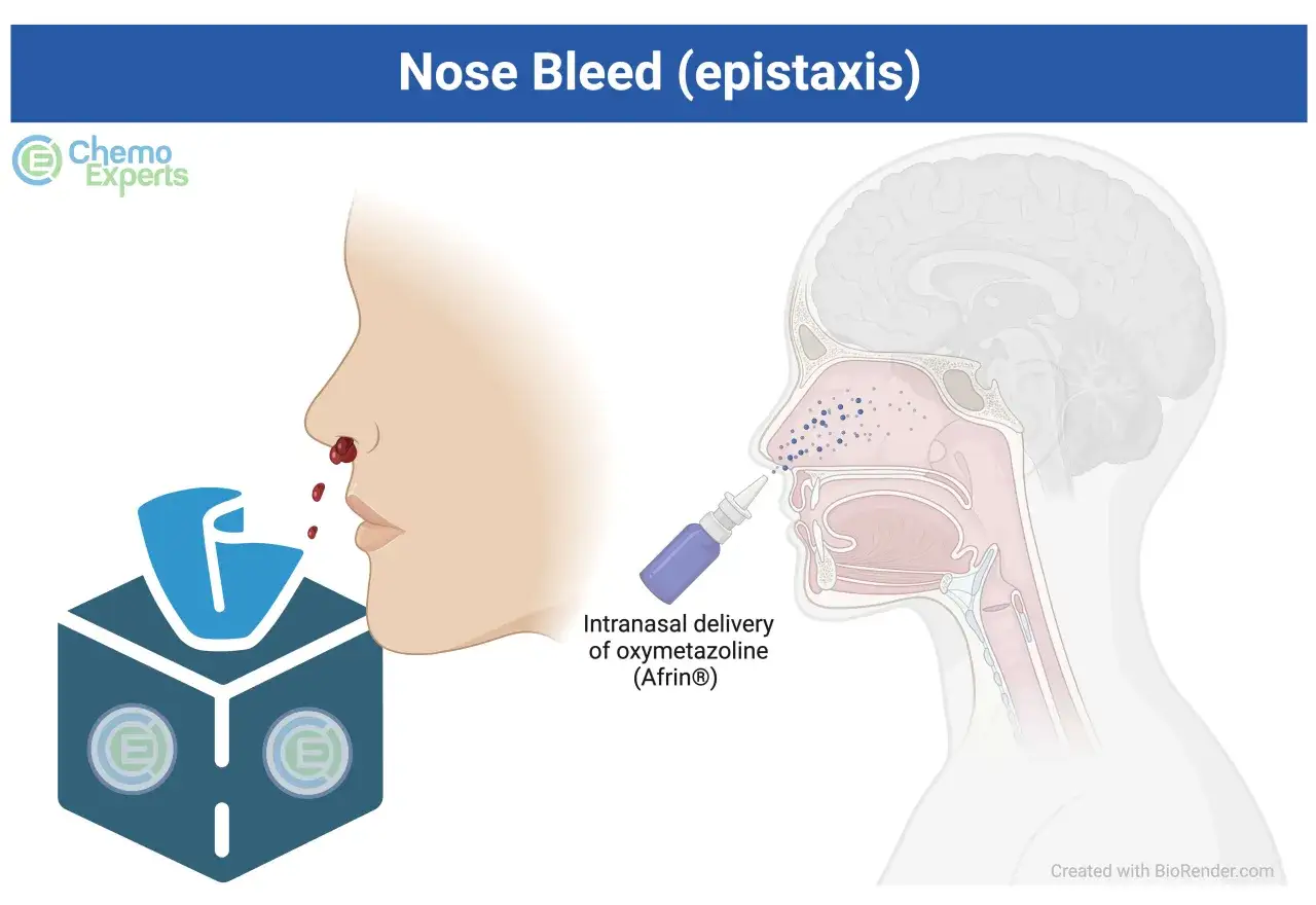 Krew z nosa kapie na chusteczkę. Obok schematyczny przekr&oacute;j nosa, do kt&oacute;rego aplikowany jest aerozol.