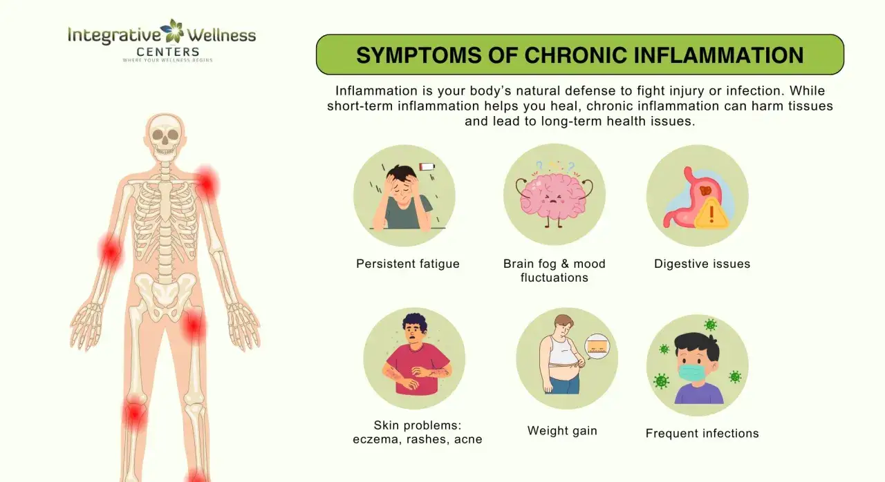 Szkielet człowieka z czerwonymi plamami na stawach, ilustrujący stan zapalny organizmu. Obok objawy: zmęczenie, mgła m&oacute;zgowa, problemy trawienne, sk&oacute;rne, przyrost wagi, częste infekcje.