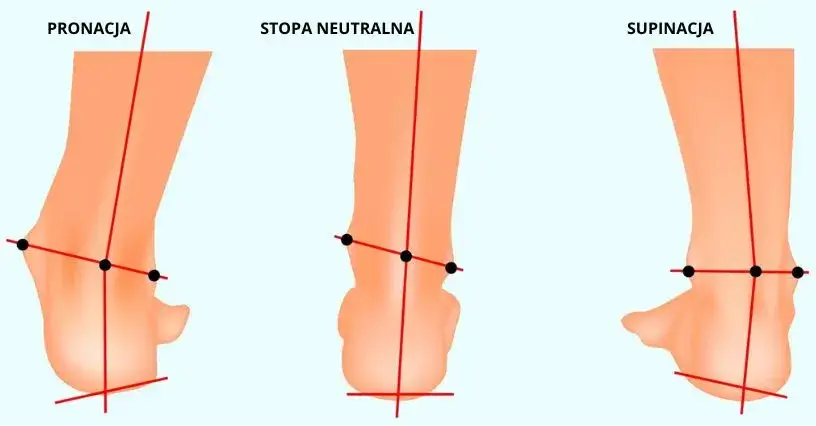rodzaje stóp pronacja supinacja neutralna diagram