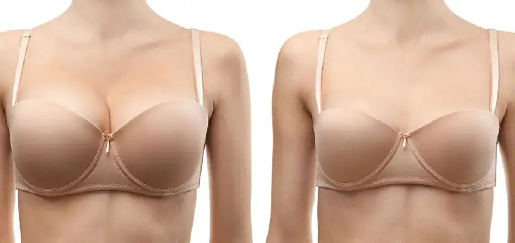 Zdjęcie Ile kosztuje ujędrnienie biustu? Ceny zabiegów i ukryte wydatki.