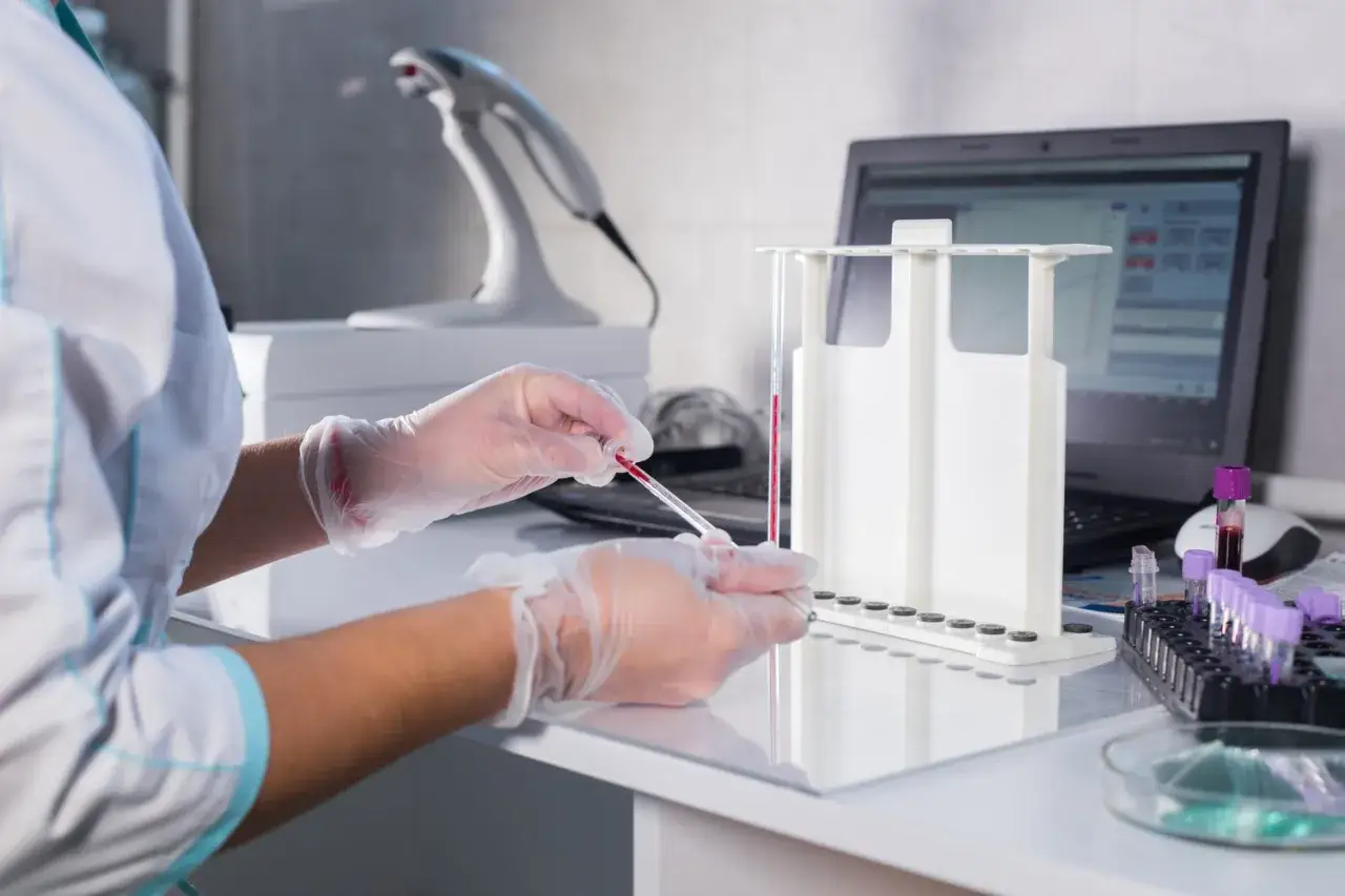 Zdjęcie Czy przed badaniem krwi można wziąć leki? Sprawdź, co wpływa na wyniki!