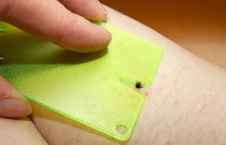 Zdjęcie Jak bezpiecznie usunąć resztki kleszcza i uniknąć poważnych konsekwencji