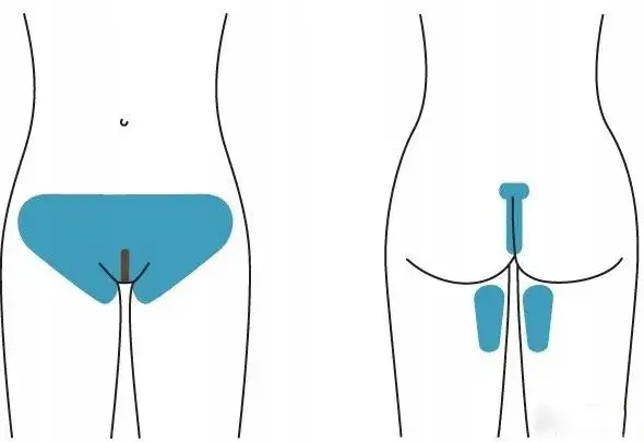 Zdjęcie Jak golić miejsce intymne u kobiet bez podrażnień i bólu