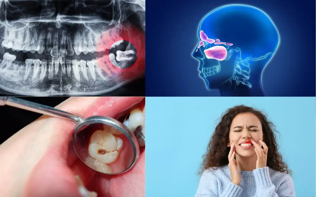 RTG szczęki, zatoki, zepsuty ząb i kobieta z b&oacute;lem sugerują, że b&oacute;l ucha od zęba może być powiązany z problemami stomatologicznymi.