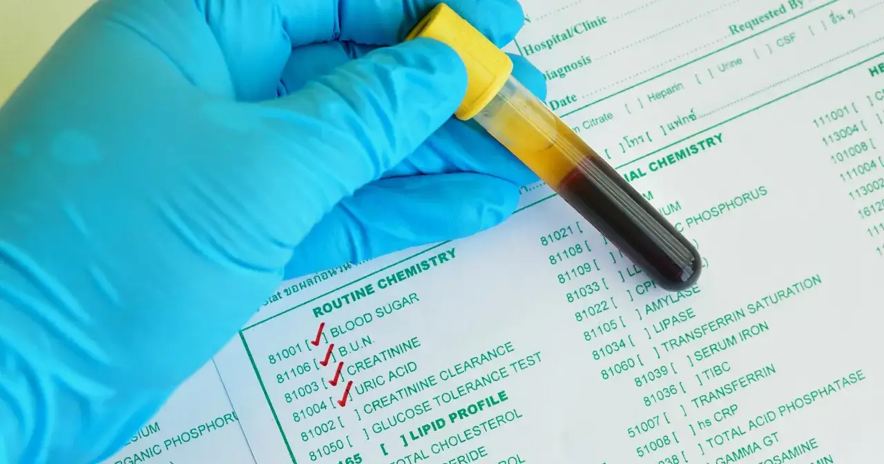 Rękawiczka w niebieskiej rękawiczce trzyma prob&oacute;wkę z krwią. Na papierze widać listę badań, w tym 