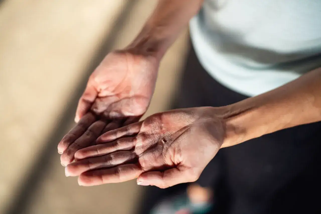 Dłonie sportowca z widocznymi modzelami, świadectwo ciężkiej pracy i determinacji.