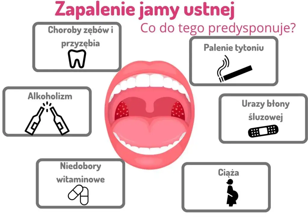 r&oacute;żne rodzaje zapalenia jamy ustnej objawy wizualne