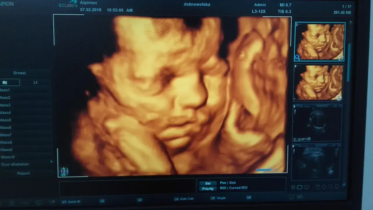 Badanie USG ciąży, widoczny ekran z obrazem płodu