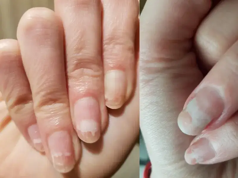 Zdjęcie Dlaczego hybryda zmienia kolor? Przyczyny i skuteczne sposoby zapobiegania