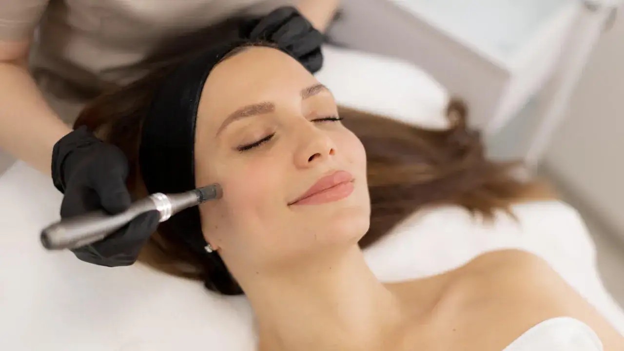 Zabieg mikronakłuwania dla pięknej twarzy 40-latki. Skóra odzyskuje blask i jędrność.