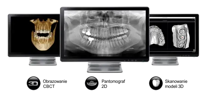 nowoczesna diagnostyka stomatologiczna rvg cbct