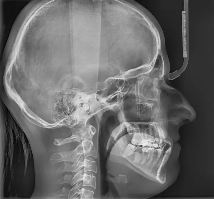 diagnostyka ortodontyczna wyciski rtg