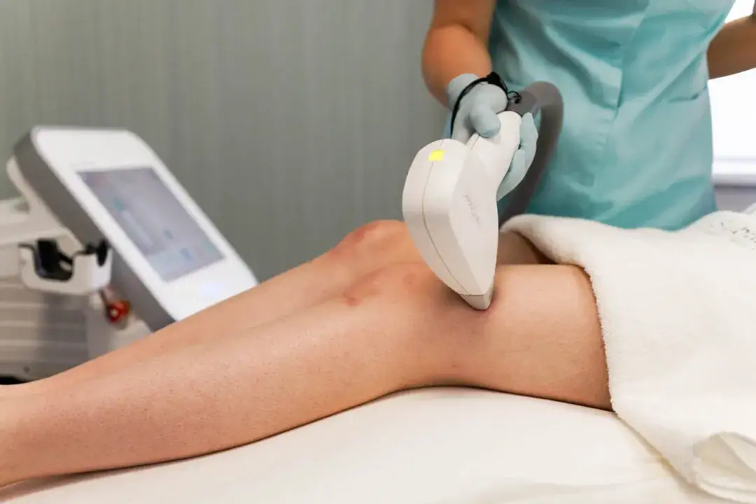 depilacja laserowa a słońce, ryzyko poparzeń po laserze