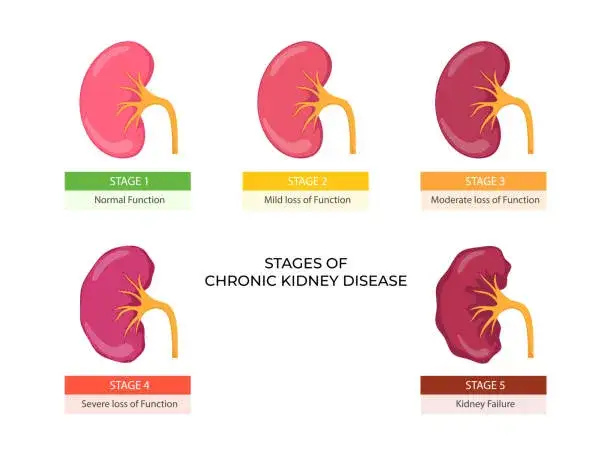 choroby nerek i pęcherza moczowego grafika