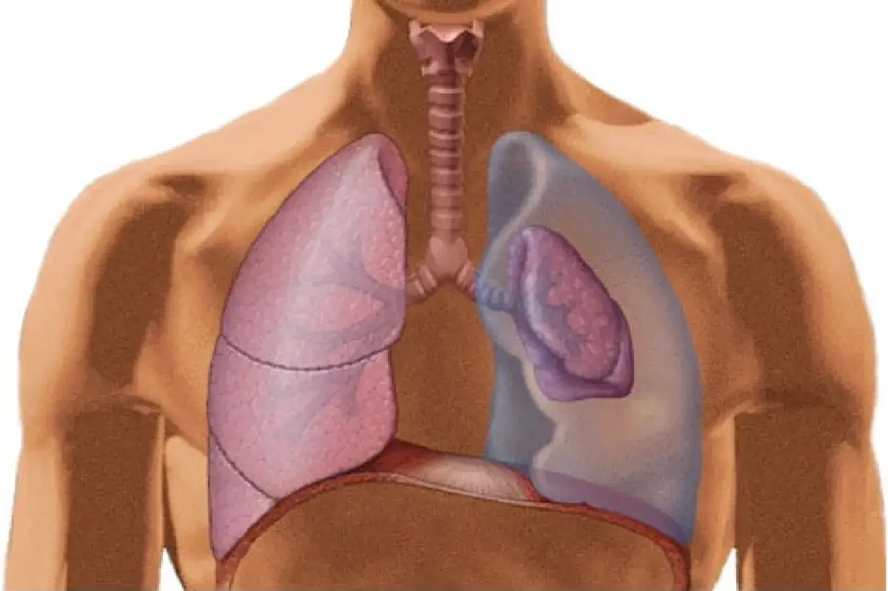 Anatomia płuc z widoczną tchawicą i przeponą. Po prawej stronie, w przezroczystej klatce piersiowej, uwidoczniona jest odma płucna.