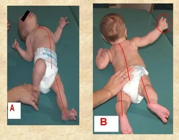 Zdjęcie Jak masować dziecko z napięciem mięśniowym, aby przynieść ulgę i relaks