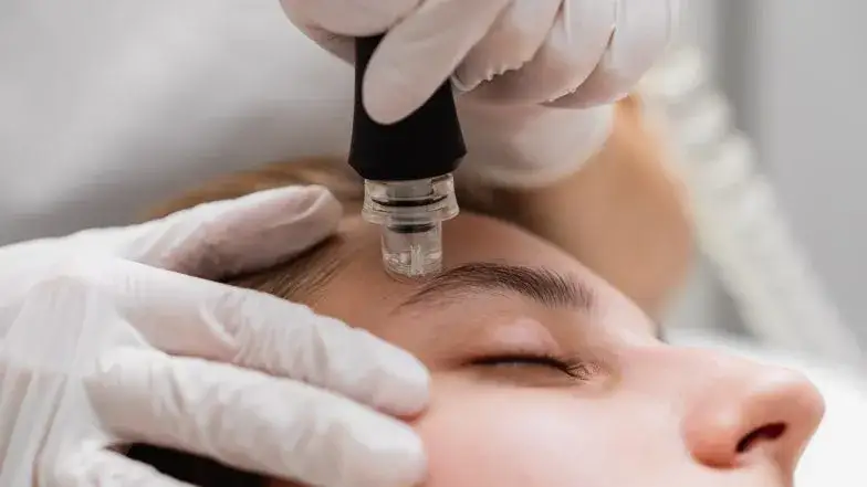 Zdjęcie Ile kosztuje mikrodermabrazja? Sprawdź ceny i ukryte koszty