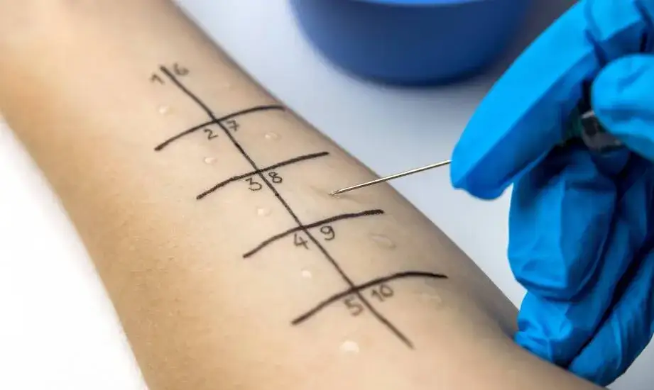 wizyta u alergologa diagnostyka