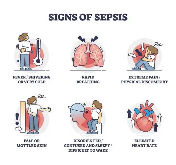 objawy sepsy infografika