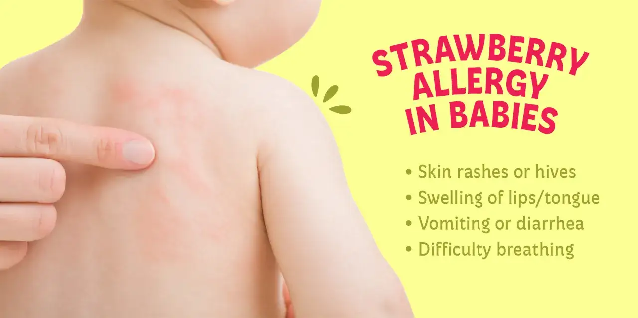 Czerwone plamy na sk&oacute;rze dziecka, pokazujące jak wygląda uczulenie na truskawki.