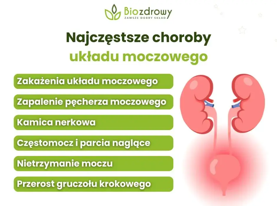 Objawy chorób układu moczowego u dorosłych