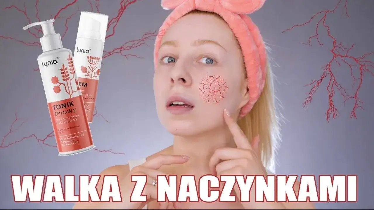 Zdjęcie Najlepsze kwasy do cery naczynkowej - jak je stosować bezpiecznie
