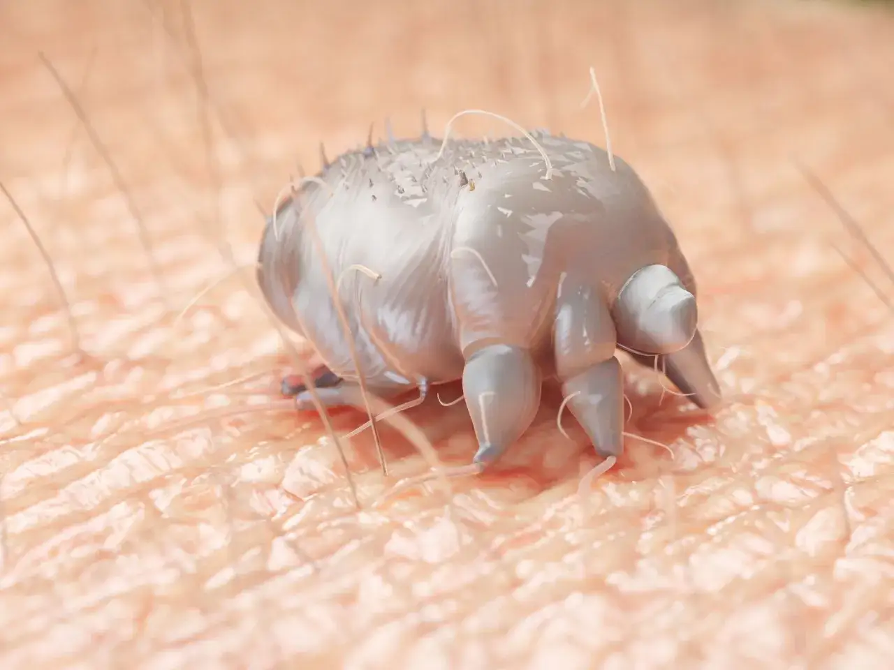 Widok roztocza Demodex na sk&oacute;rze. Iwermektyna co to? Lek na pasożyty.