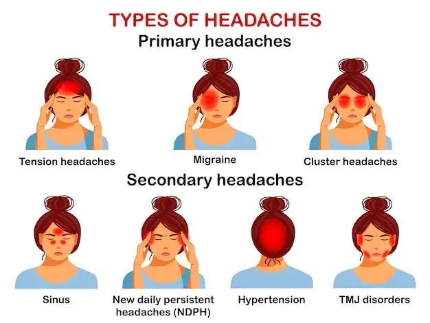 różne rodzaje bólów głowy infografika