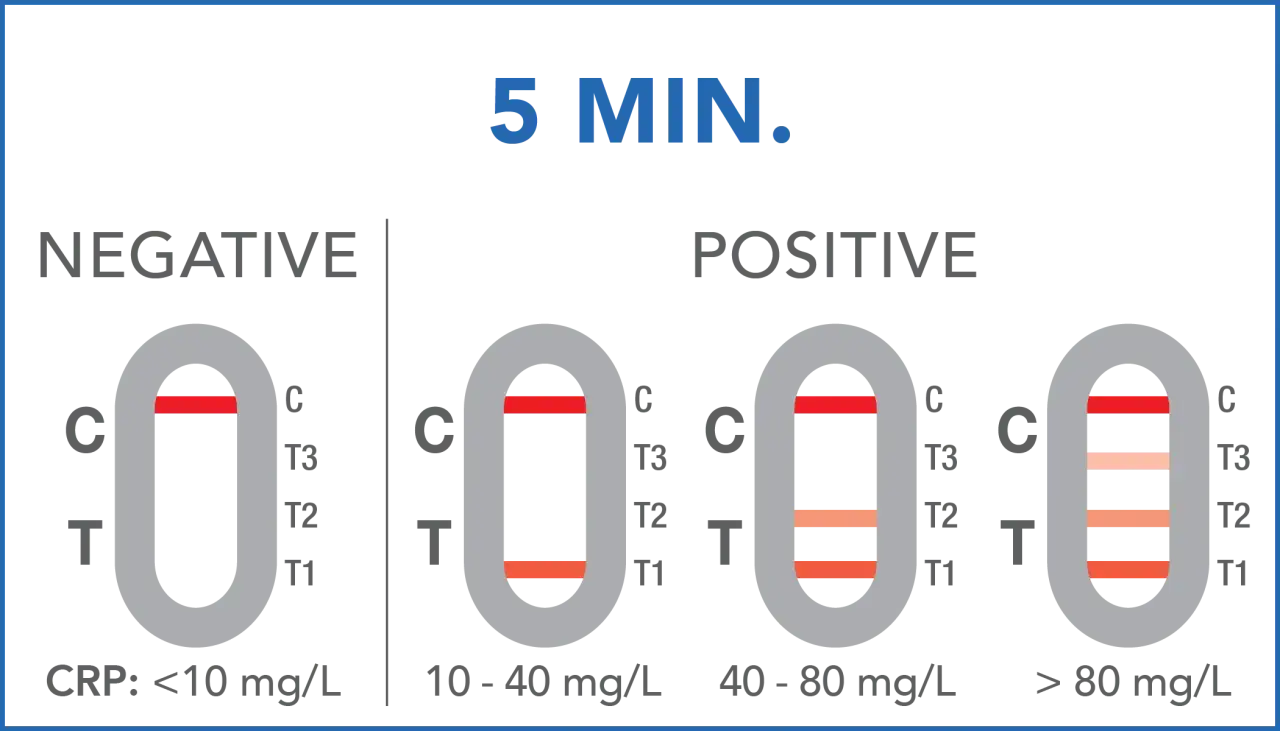 Wynik CRP > 10 mg/L może niepokoić. Testy pokazują różne poziomy CRP: negatywny (<10), lekko pozytywny (10-40), umiarkowanie (40-80) i wysoki (>80).