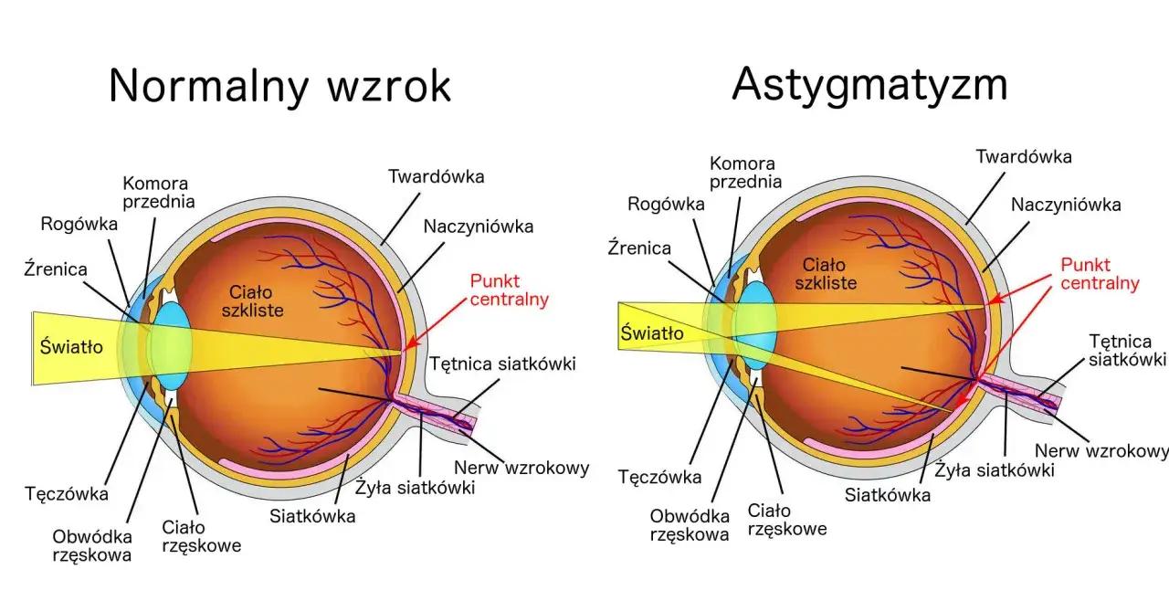 schemat osi astygmatyzmu 0-180 stopni