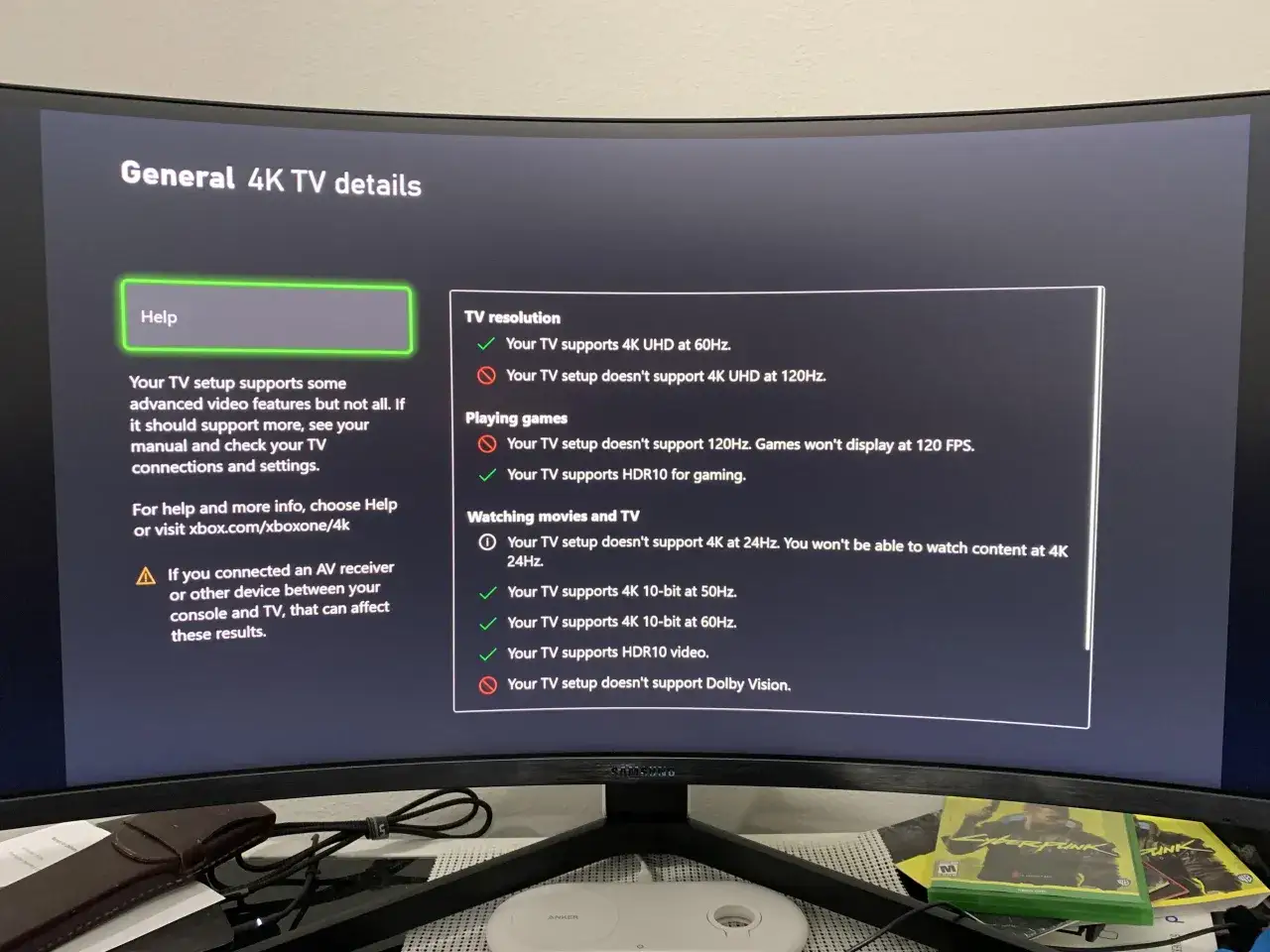 gaming setup xbox series x monitor 4k 120hz