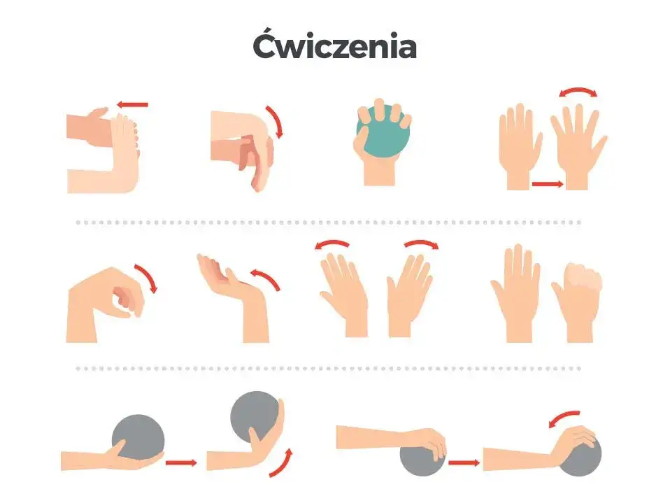 prawidłowe ułożenie ręki po operacji cieśni nadgarstka, ćwiczenia palc&oacute;w po operacji nadgarstka
