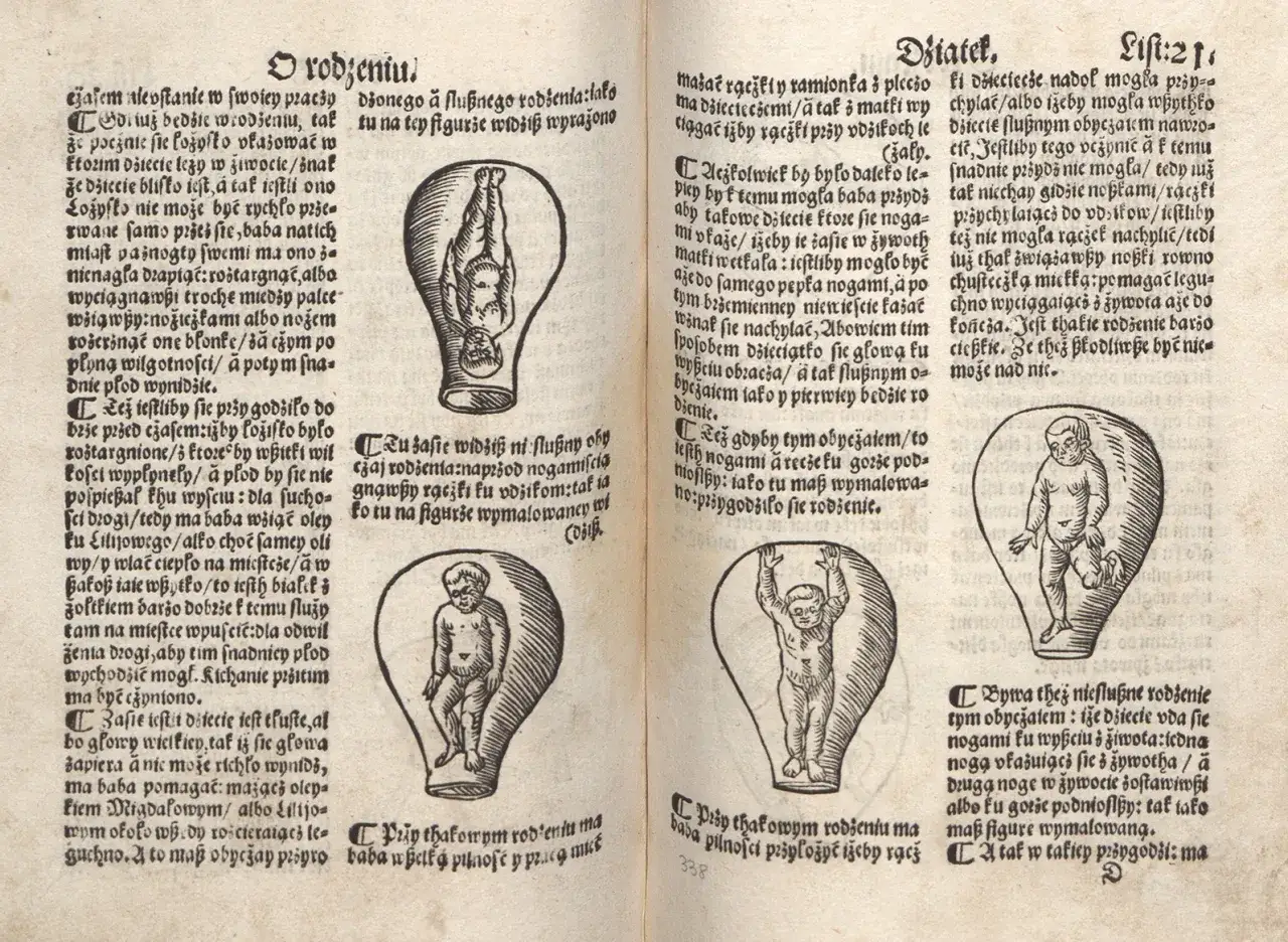 Średniowieczne amulety porodowe zabobony