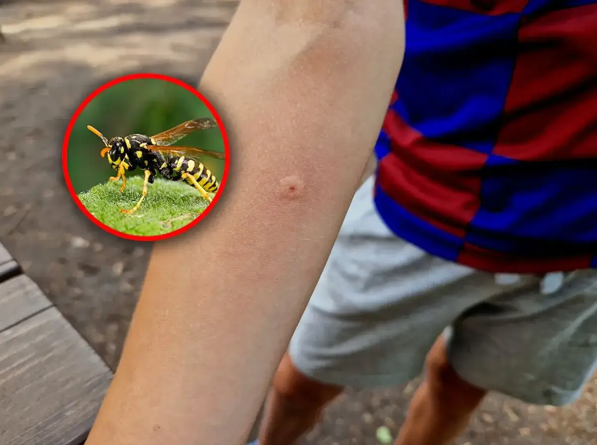 Ślad po ugryzieniu szerszenia na ręce, obok zbliżenie owada.