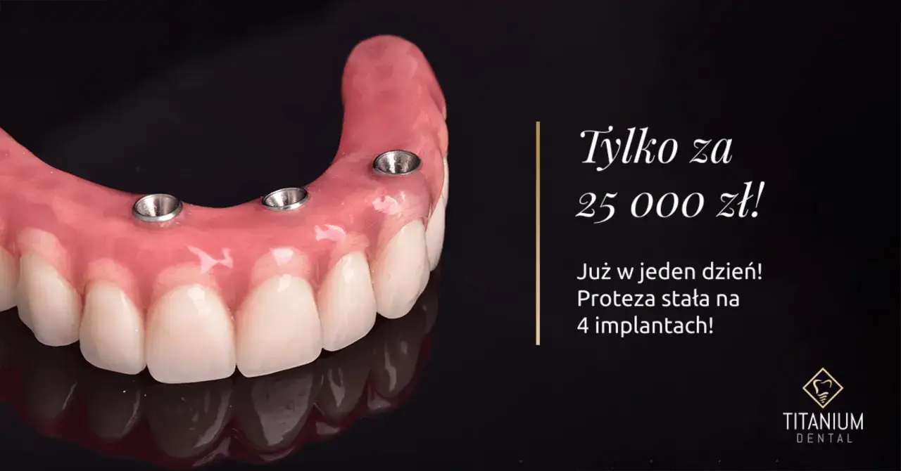 Ile kosztuje wprawienie zęba? Proteza stała na 4 implantach za 25 000 zł.