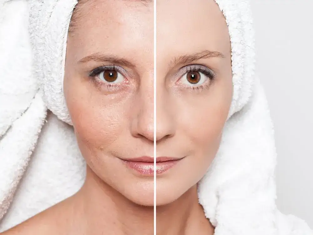 regeneracja zdrowa sk&oacute;ra