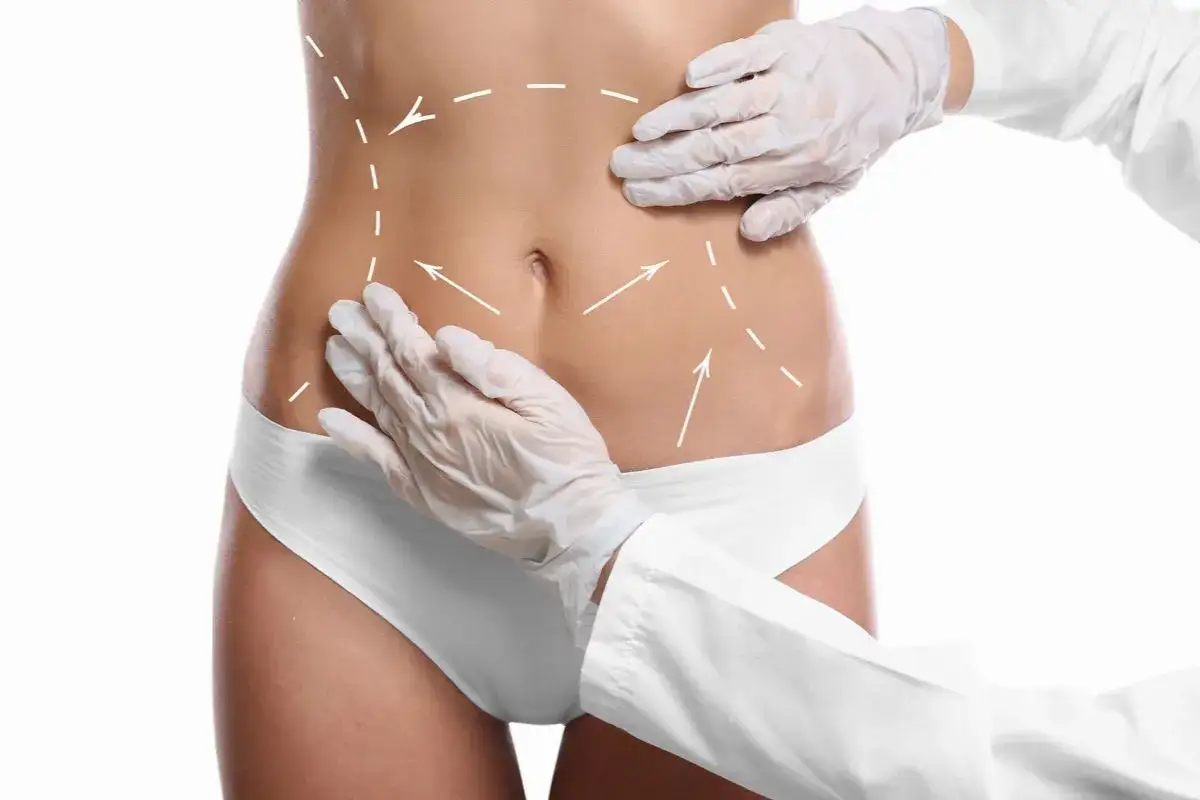 kobieta w odzieży uciskowej po liposukcji