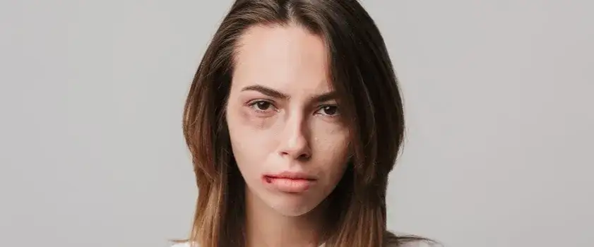 Zdjęcie Czy syndrom sztokholmski istnieje? Naukowa prawda vs. mit