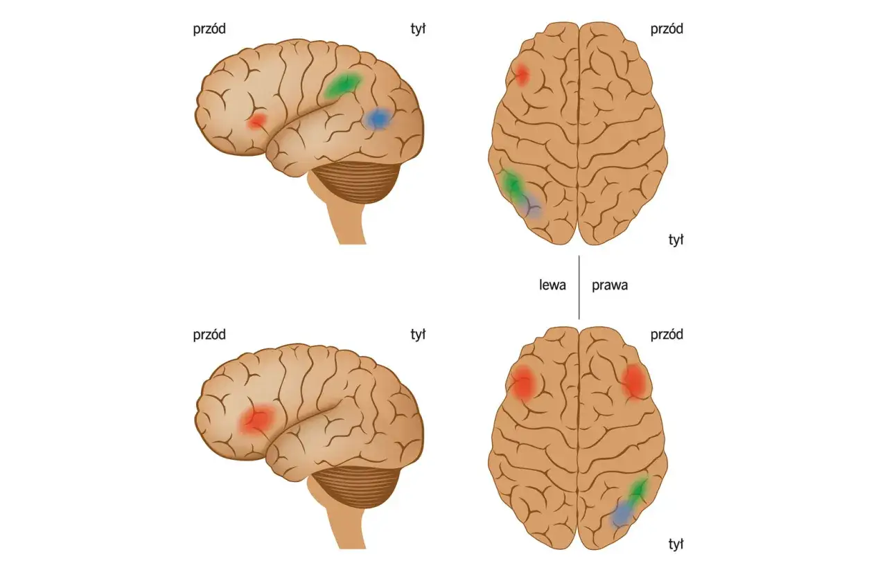 mózg dysleksja różnice