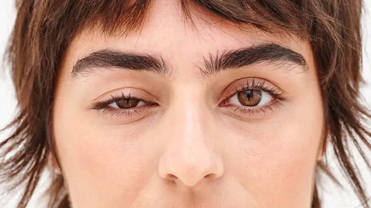 powikłania po botoksie czoła ptoza asymetria efekt Mefisto