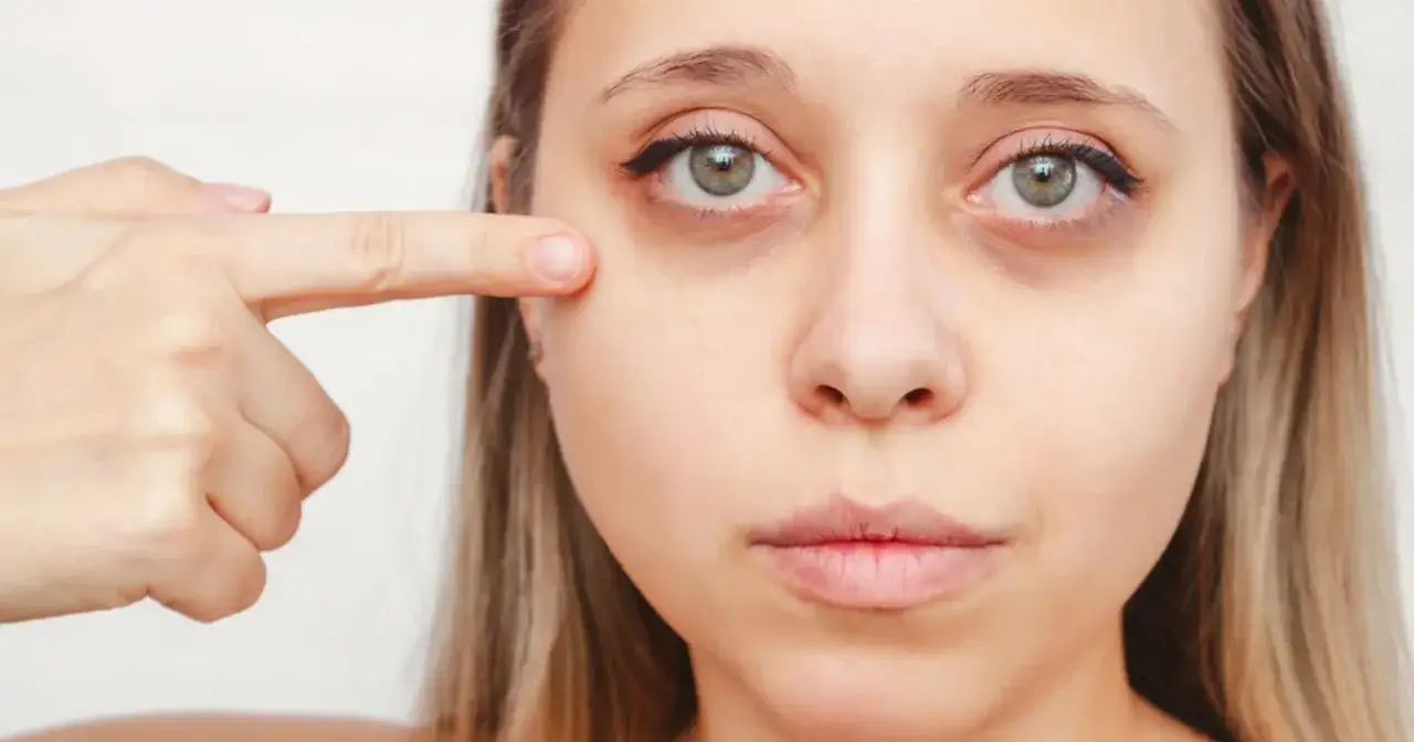 Objawy niedoboru witaminy A na sk&oacute;rze i oczach