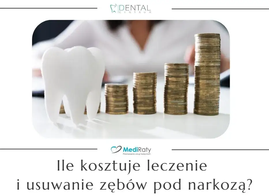 koszt usunięcia zębów narkoza schemat