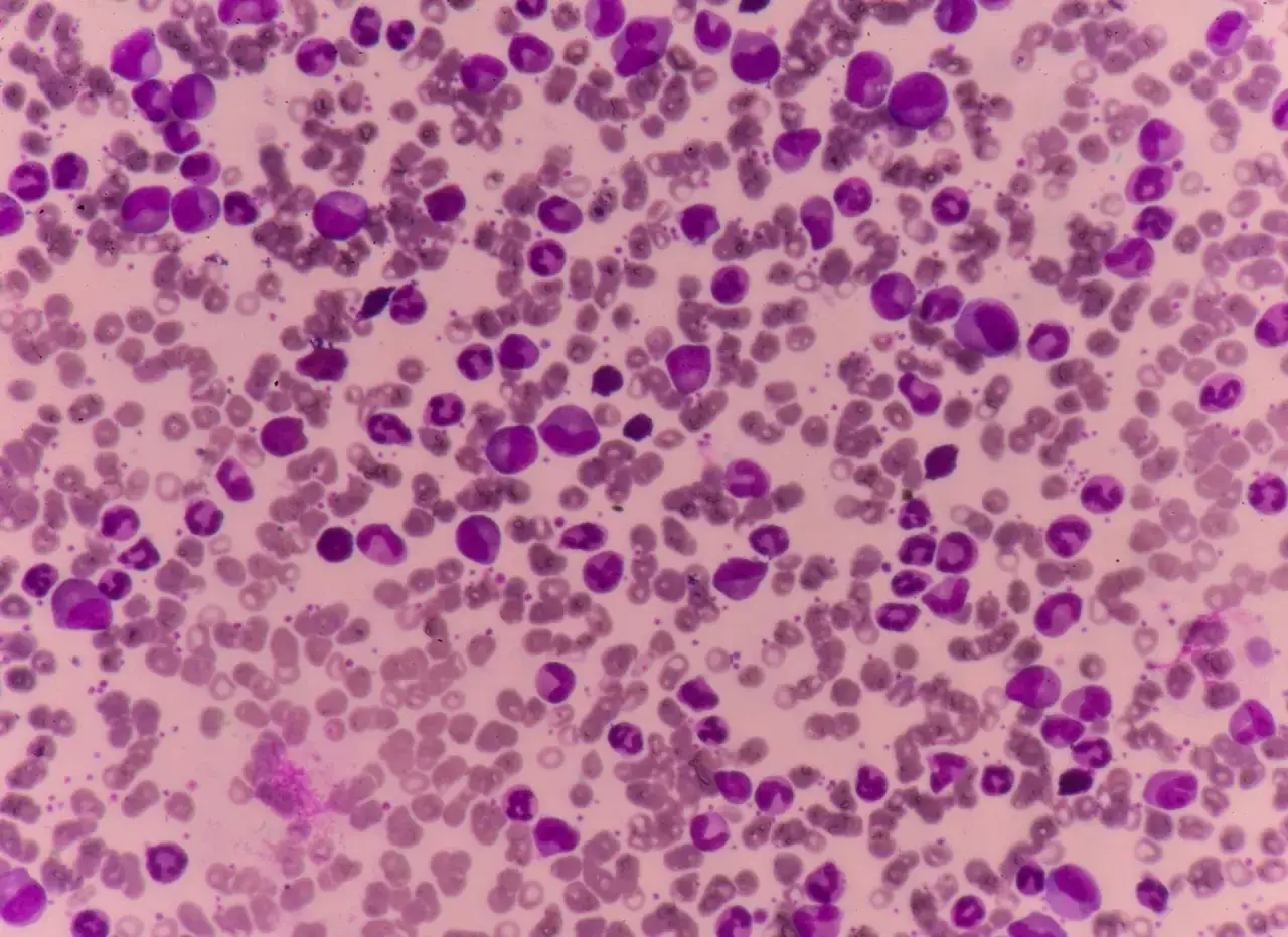 mikroskopowy obraz bazofili we krwi