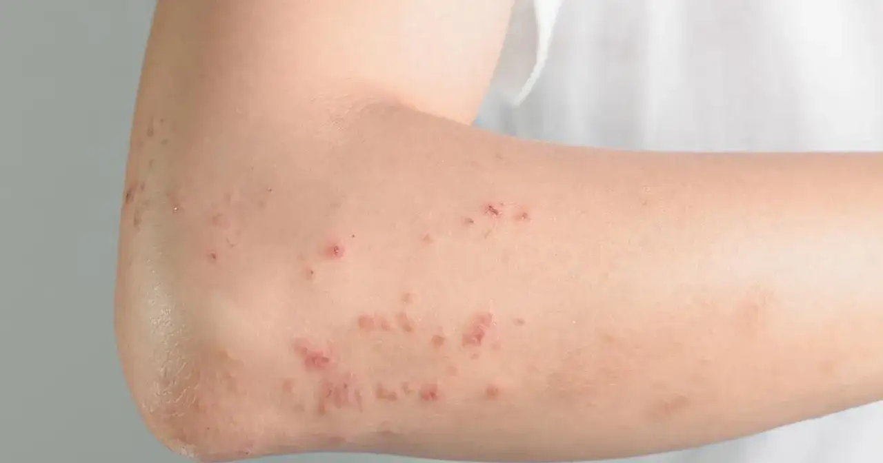 zegar biologiczny histamina alergia