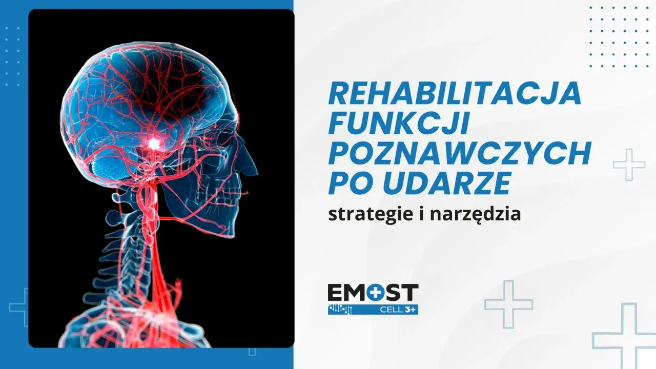 Rehabilitacja funkcji poznawczych po udarze. Jak ćwiczyć pamięć? Grafika przedstawia m&oacute;zg z naczyniami krwionośnymi.