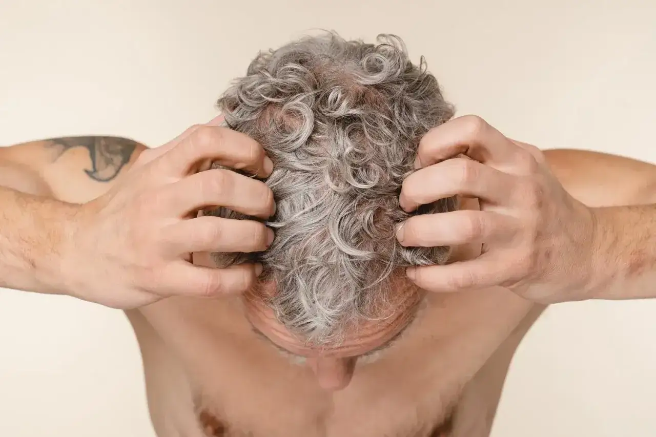 Zdjęcie Wie viele Haare hat der Mensch? Die &uuml;berraschende Antwort