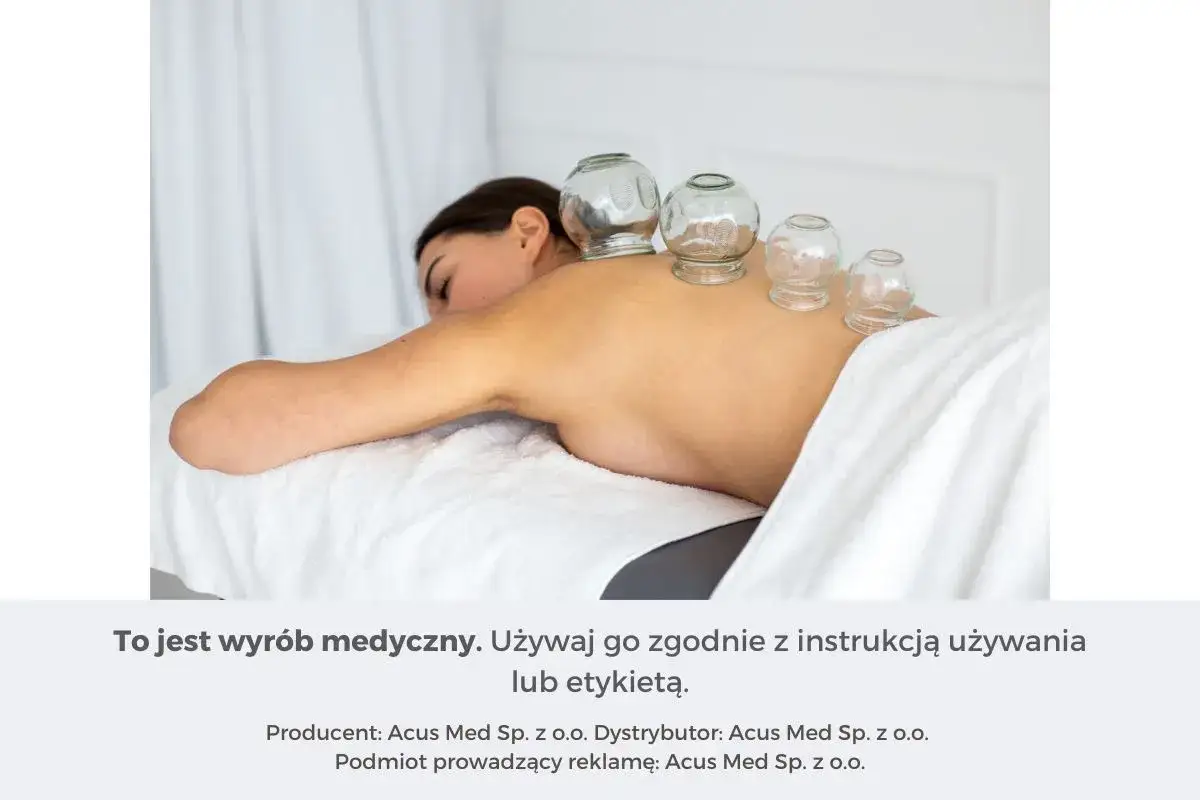 Kobieta z bańkami na plecach. Terapia bańkami stosowana jest w celu rozluźnienia mięśni i poprawy krążenia.