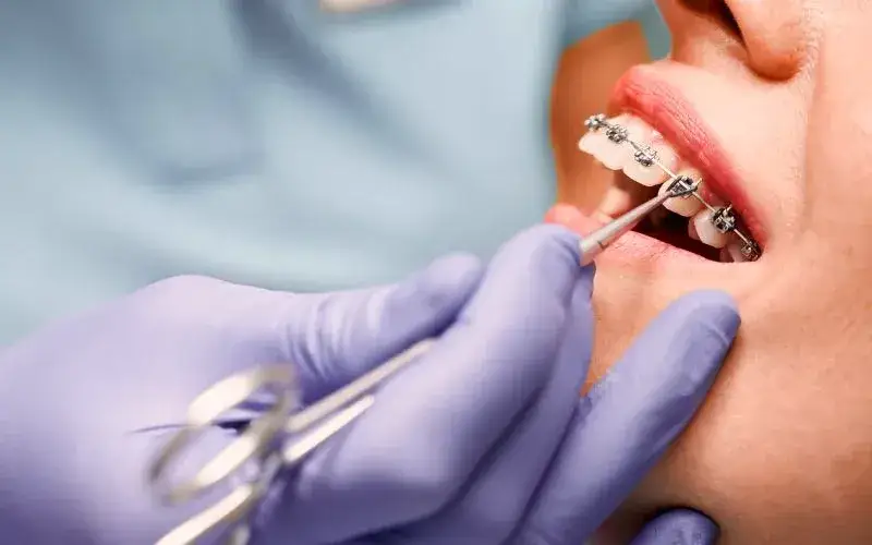 ortodonta konsultacja gabinet dentystyczny
